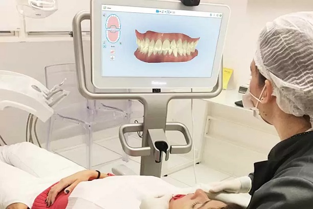 Escaneamento Intraoral 3D