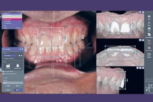 Planejamento Digital do Sorriso